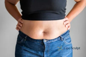 Bidding Farewell to Muffin Tops with Aqualyx Fat Injections 2 Do you wish you could reduce your muffin top Hall Green With Aqualy fat dissolving injections you can!