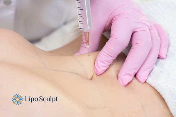 Aqualyx for Muffin Tops: What to Know Before Fat-Dissolving Injections 4 Are there risks Hall Green?