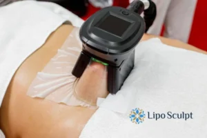 Fat freezing at home from Lipo Sculpt Hall Green